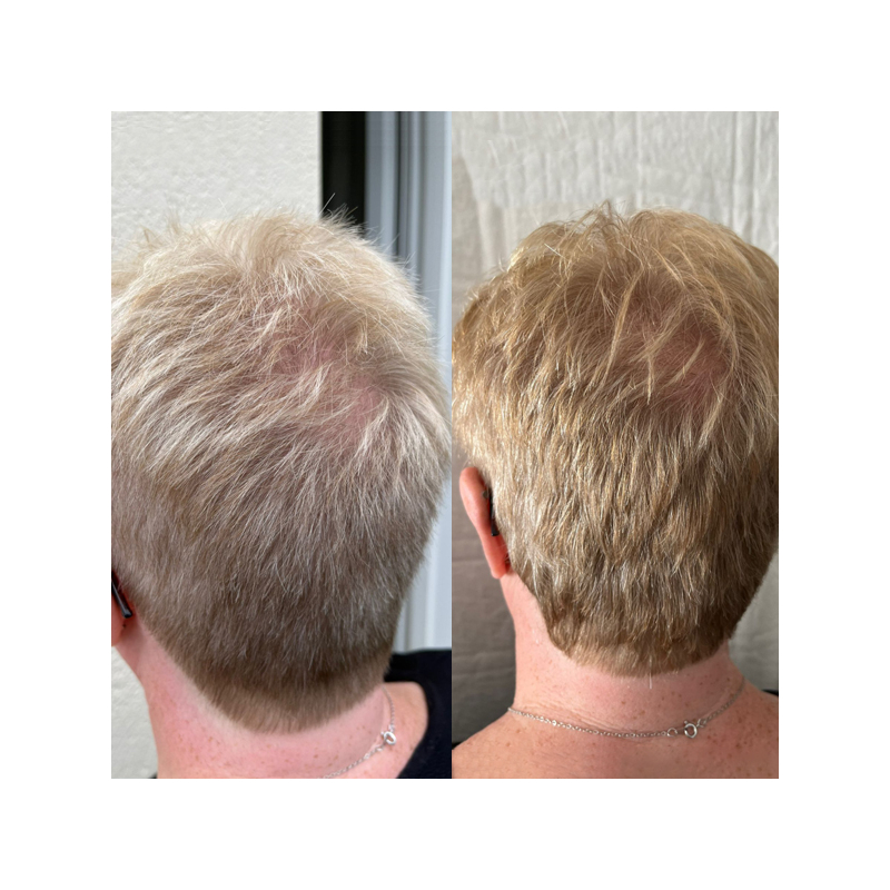 KIT coloration blond doré